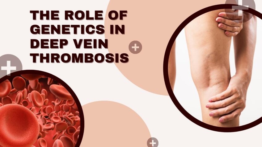 The Role of Genetics in Deep Vein Thrombosis